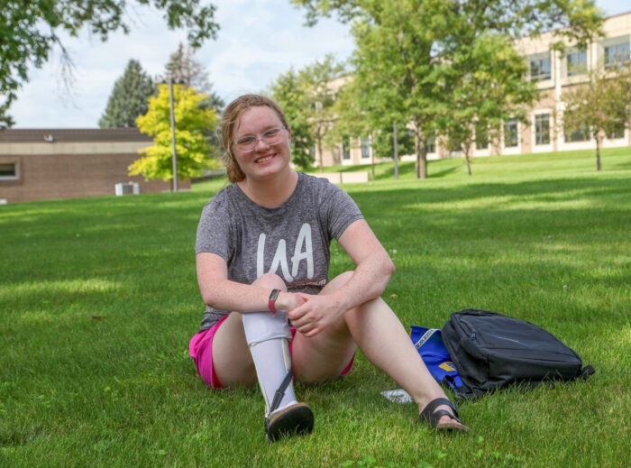 photo of student with prosthetic